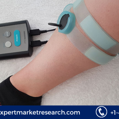 Bone Growth Stimulators Market Share