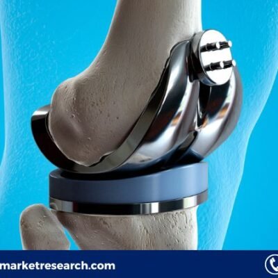 Medical Implant Market