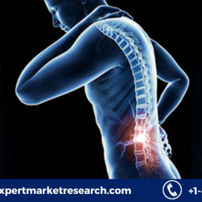 Spinal Cord Stimulation Market Share