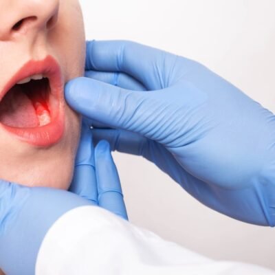 Oral Cancer Treatment Market