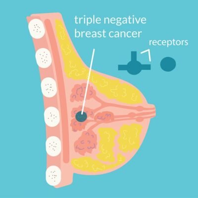 Triple-negative Breast Cancer Market